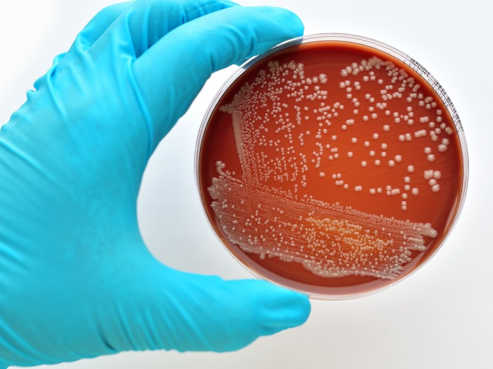 bacteria